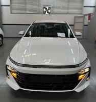 Bán xe Hyundai Accent 2026 1.5 AT giá 463 Triệu - Hà Nội