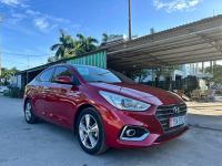 Bán xe Hyundai Accent 2020 1.4 ATH giá 395 Triệu - Hải Phòng