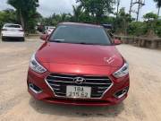 Bán xe Hyundai Accent 2020 1.4 AT giá 403 Triệu - Hải Phòng