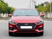 Bán xe Hyundai Accent 2020 1.4 AT giá 398 Triệu - TP HCM