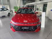 Bán xe Hyundai Accent 2025 1.5 AT giá 476 Triệu - Hà Nội