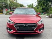 Bán xe Hyundai Accent 2018 1.4 ATH giá 399 Triệu - Hà Nội