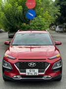 Bán xe Hyundai Kona 2021 1.6 Turbo giá 555 Triệu - TP HCM